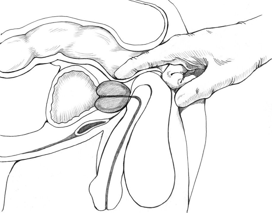 Prostate massage is included in the set of methods for treating prostatitis